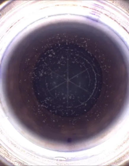 LENSAR treatment view showing the planned capsulotomy circle and fragmentation pattern